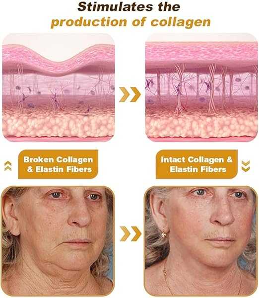 Botox Bee Venom Wrinkle Cream